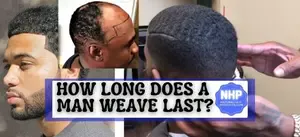 How long does a man weave last? With low-cost main weave maintenance a hair unit's duration time is 1-year plus w/ long-term installation. A few short months...