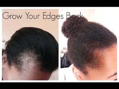 castor oil for 4c hair before after edges results