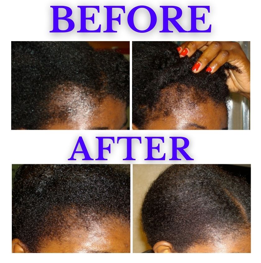 Castor Oil For 4C Hair Benefits [JBCO Before & After Results]