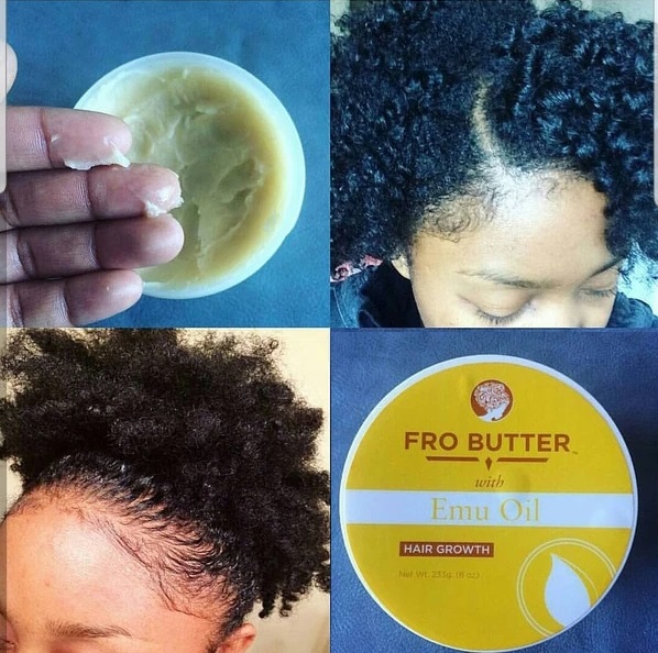 Emu Oil Hair Growth Before and After Pictures