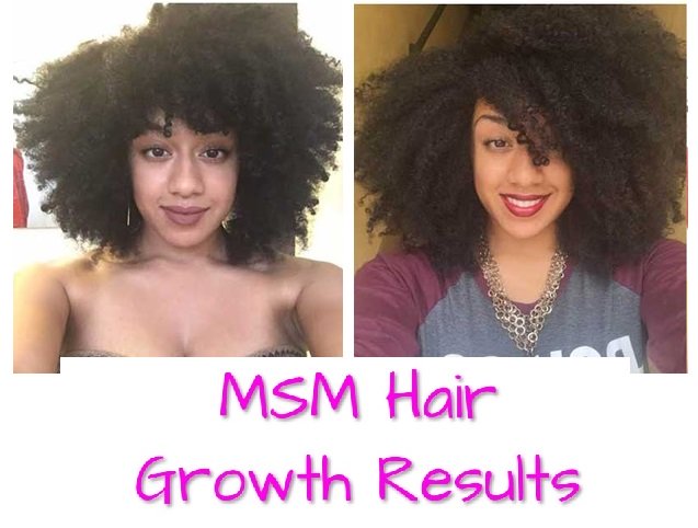 MSM hair growth before and after pictures. How much liquid MSM for hair growth oil & powder needed? See fast benefits of adding Biotin to a good topical MSM ..