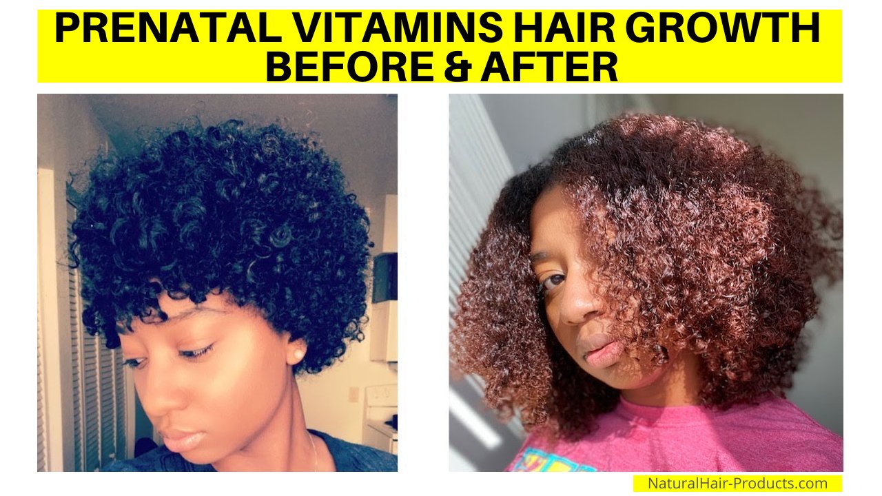 Prenatal Vitamins Hair Growth Before and After Pictures. Results after 1 year.