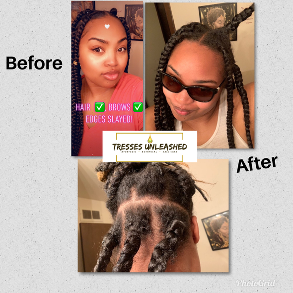 Rosemary Oil And Castor Oil For Hair Growth Before & After Review Picture #1