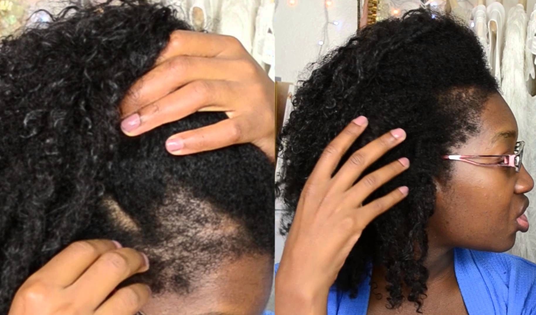 grow hair with bow braids fast. traction alopecia from tight hairstyles and hair growth. NHP